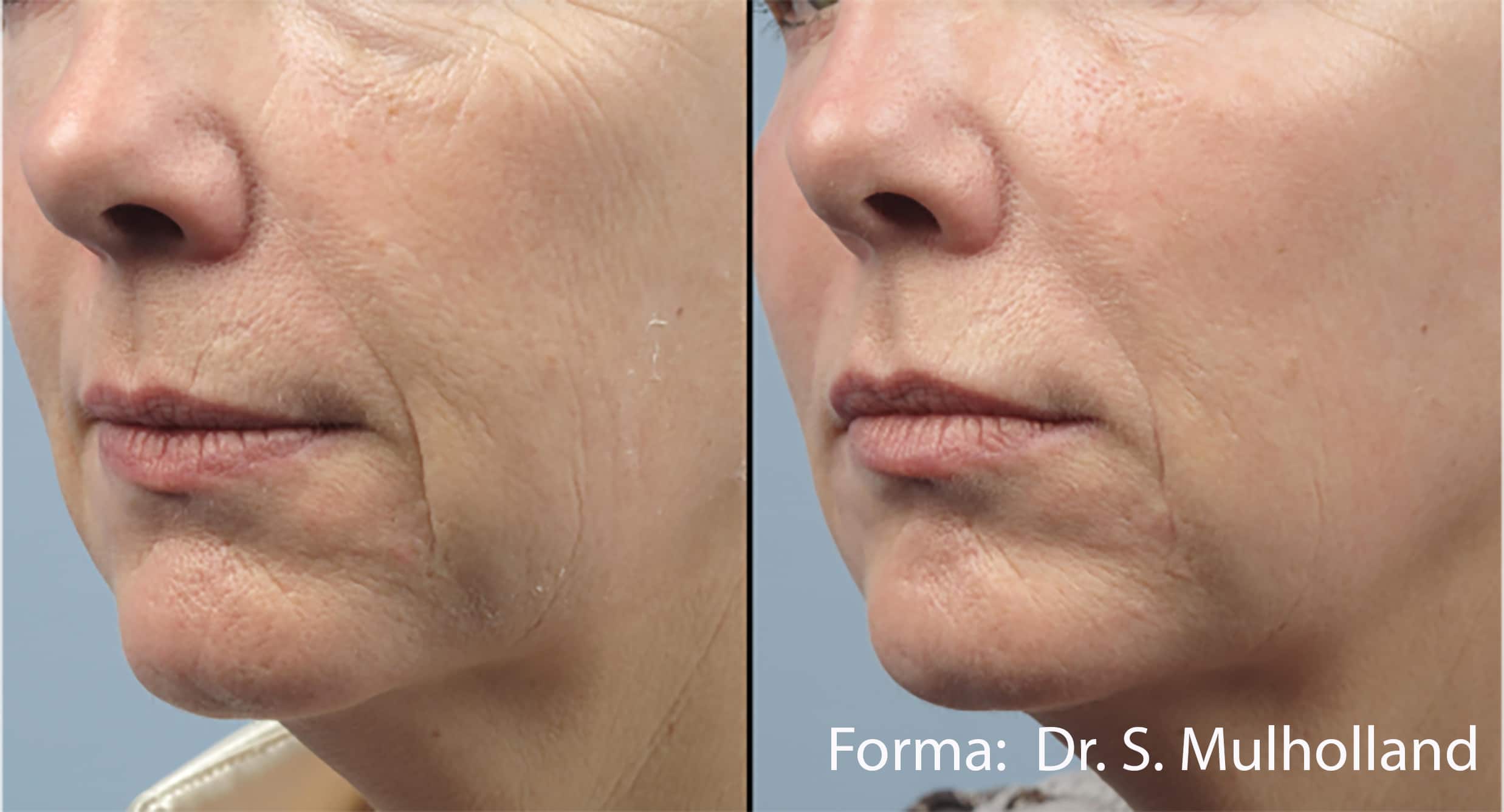 forma-before-after-dr-s-mulholland-preview-1