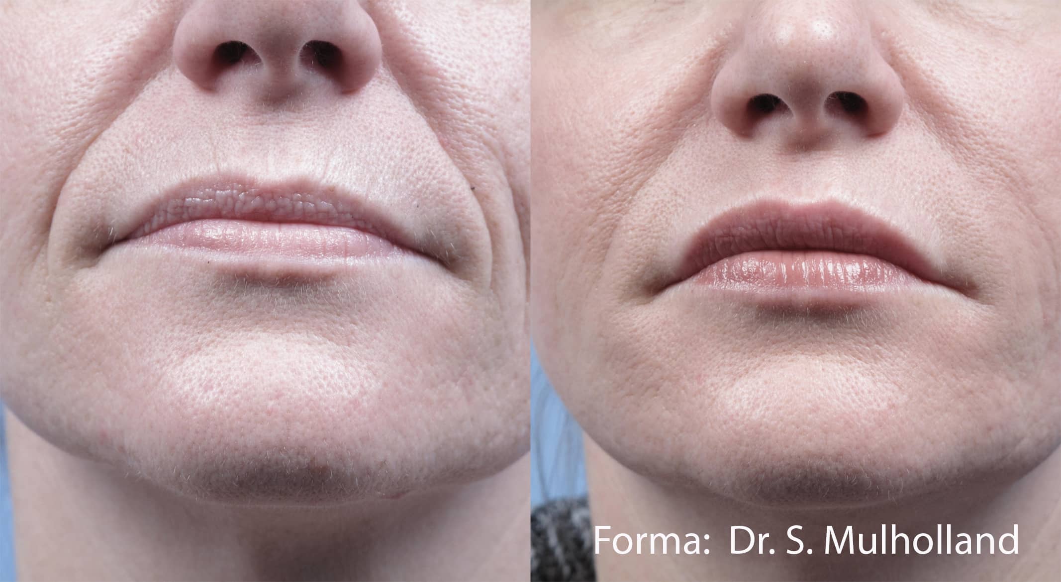 forma-before-after-dr-s-mulholland-preview-2