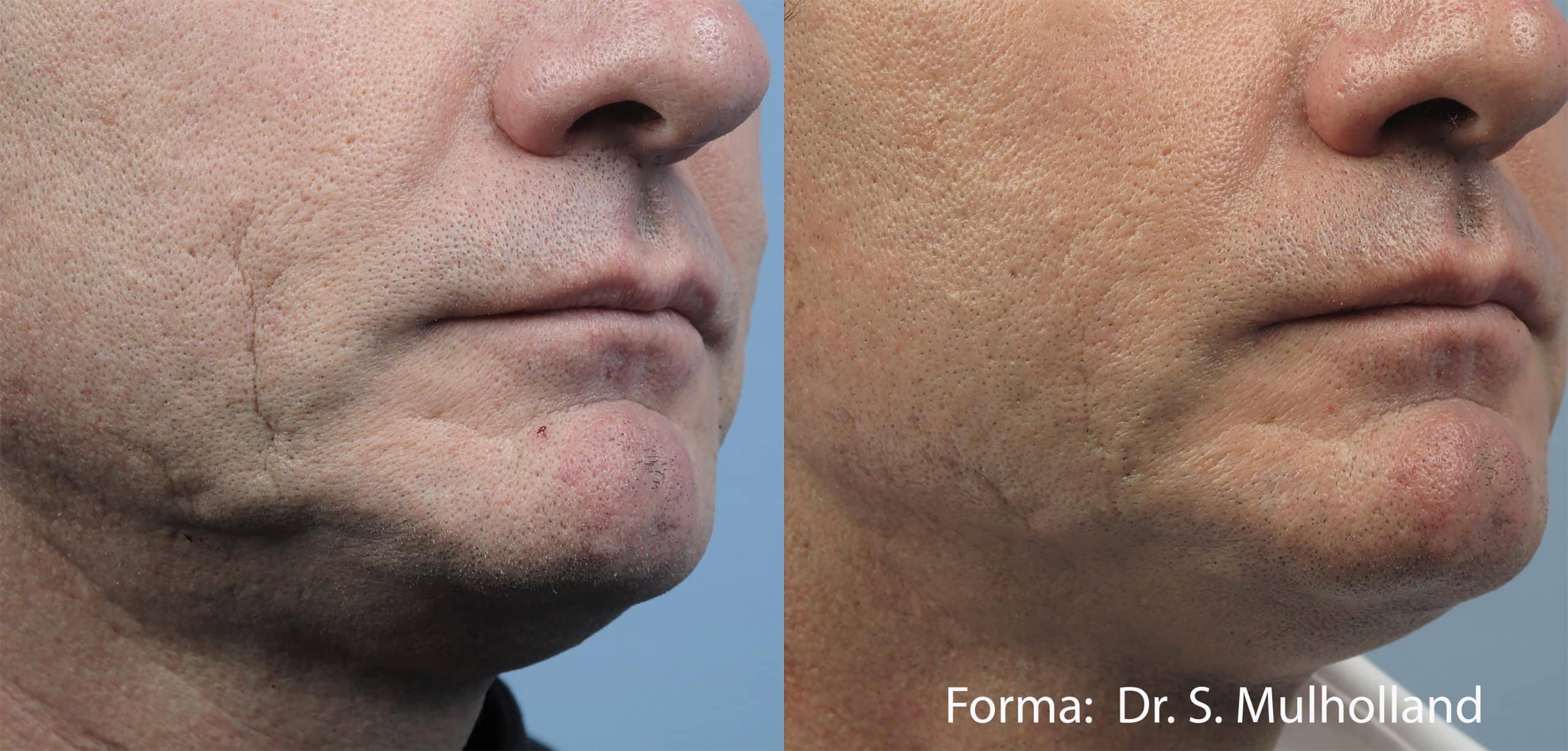 forma-before-after-dr-s-mulholland-preview-4